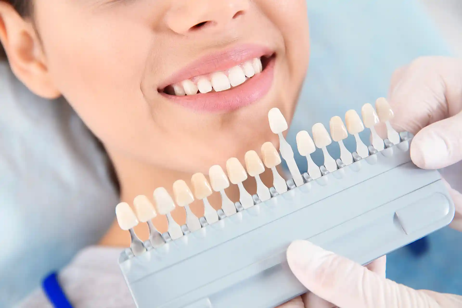 dentist selecting patient veneer colour