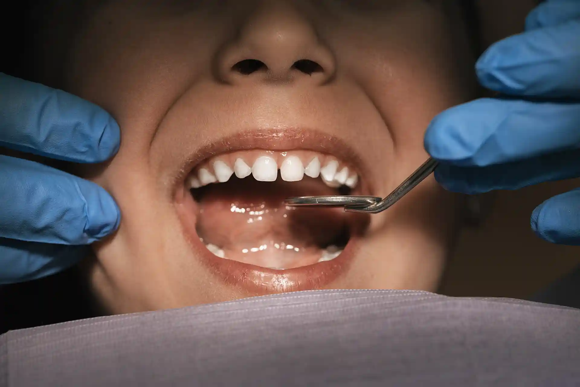 child patient in dental examination close up